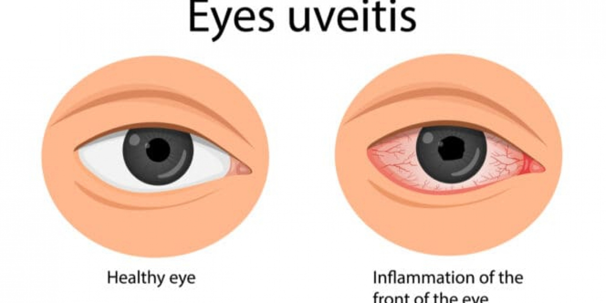 Uveitis Treatment Market Size, Projections of Share, Trends, and Growth for 2024-2032