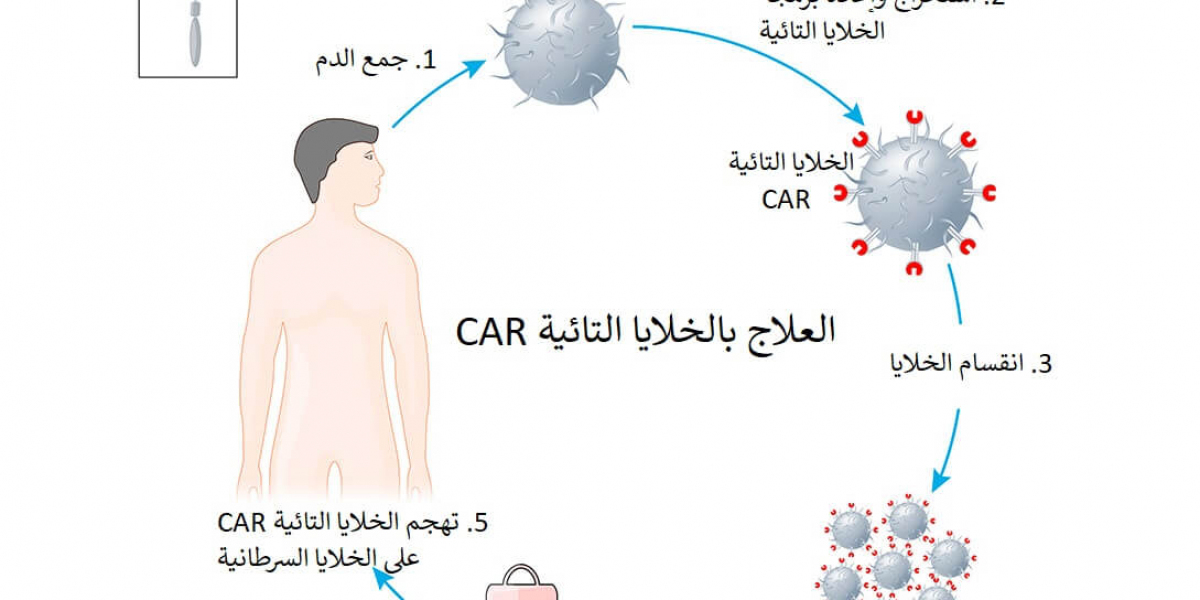 فهم النتيجة ماذا يحدث إذا فشل علاج الخلايا التائية CAR؟