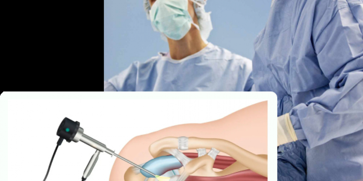 Arthroscopic Surgery Lahore – Advanced Care at Ortho Center in Pakistan