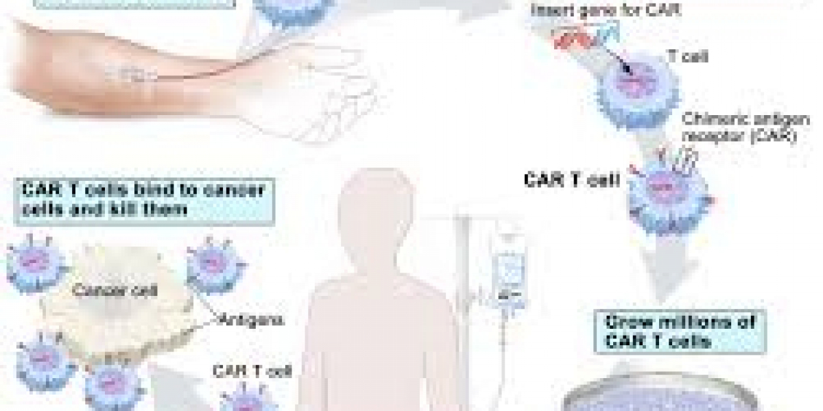 What Is CAR-T Cell Therapy and How Is It Changing Cancer Care?