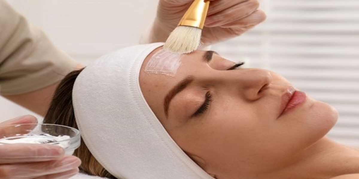 Avoiding Common Mistakes During Chemical Peel Recovery