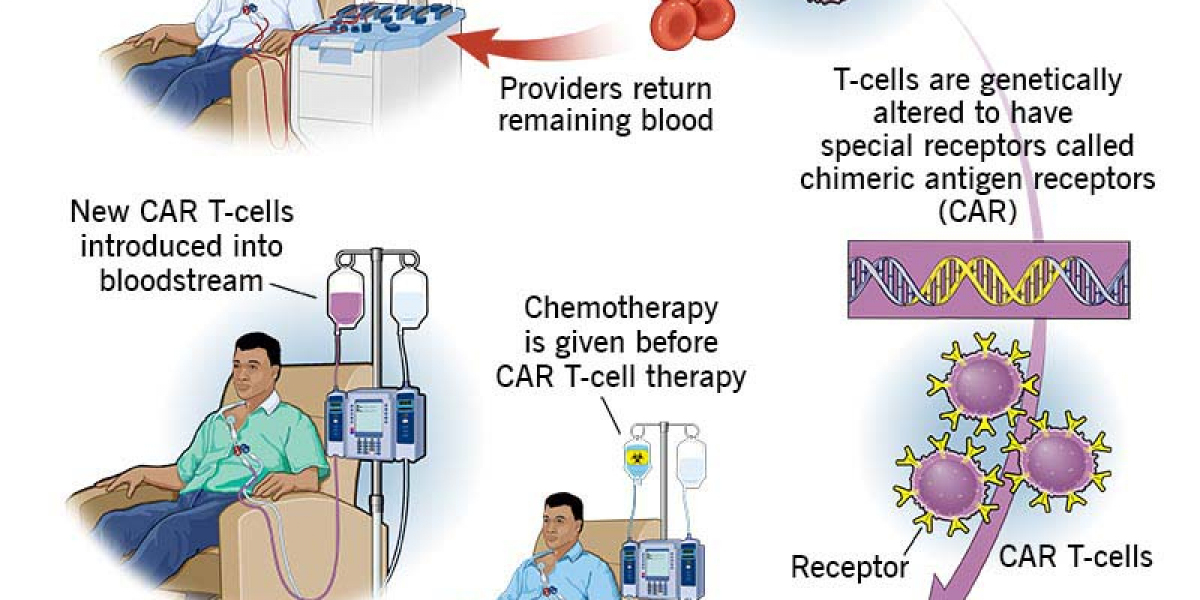 How Long Does CAR T-Cell Therapy Take to Be Effective?