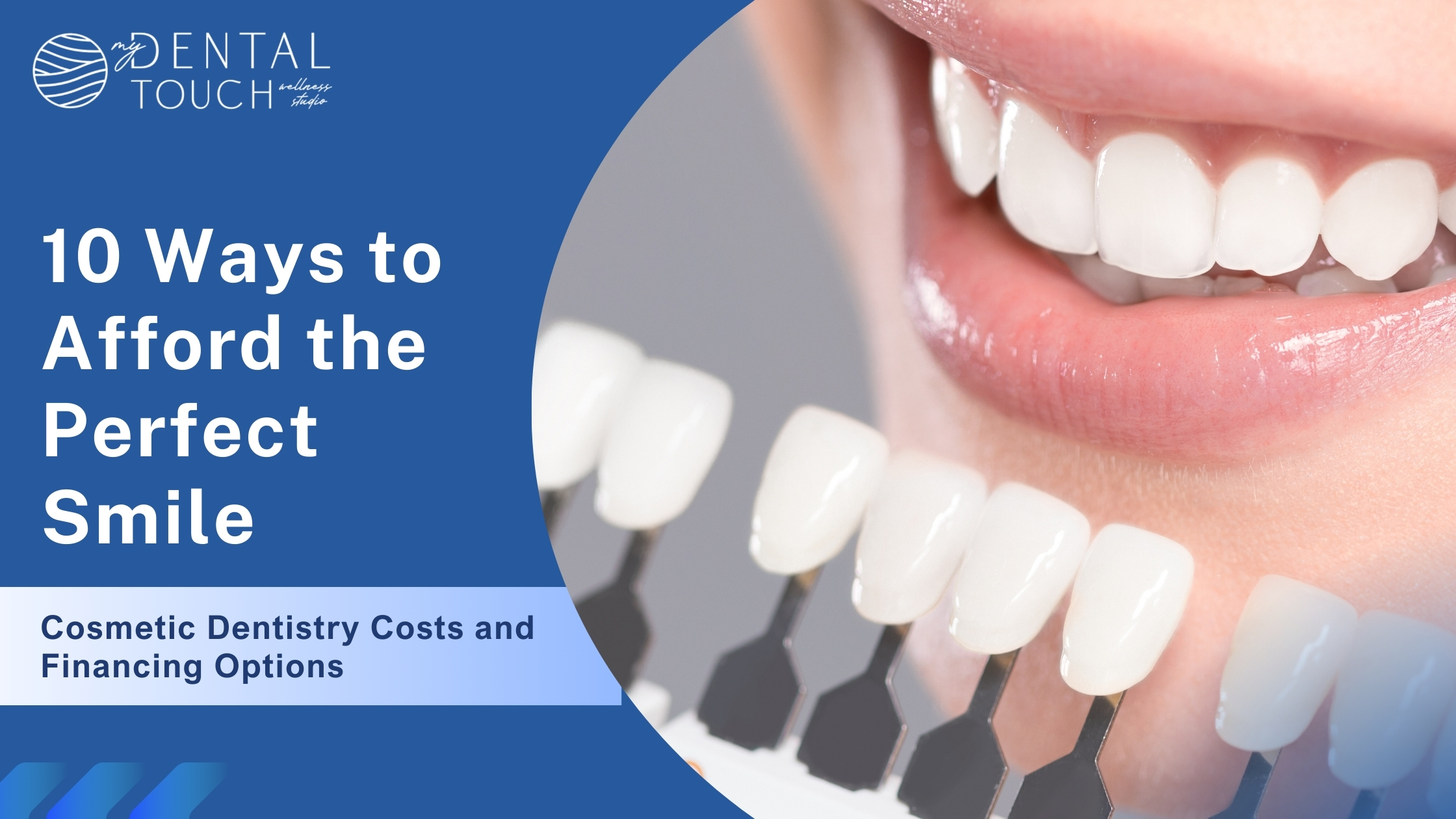 10 Ways to Afford the Perfect Smile | Cosmetic Dentistry Tips