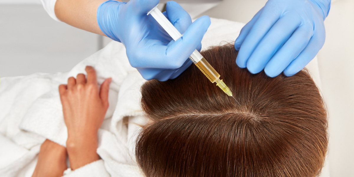 Transforming Hair Restoration: Stem Cell Therapy in New York