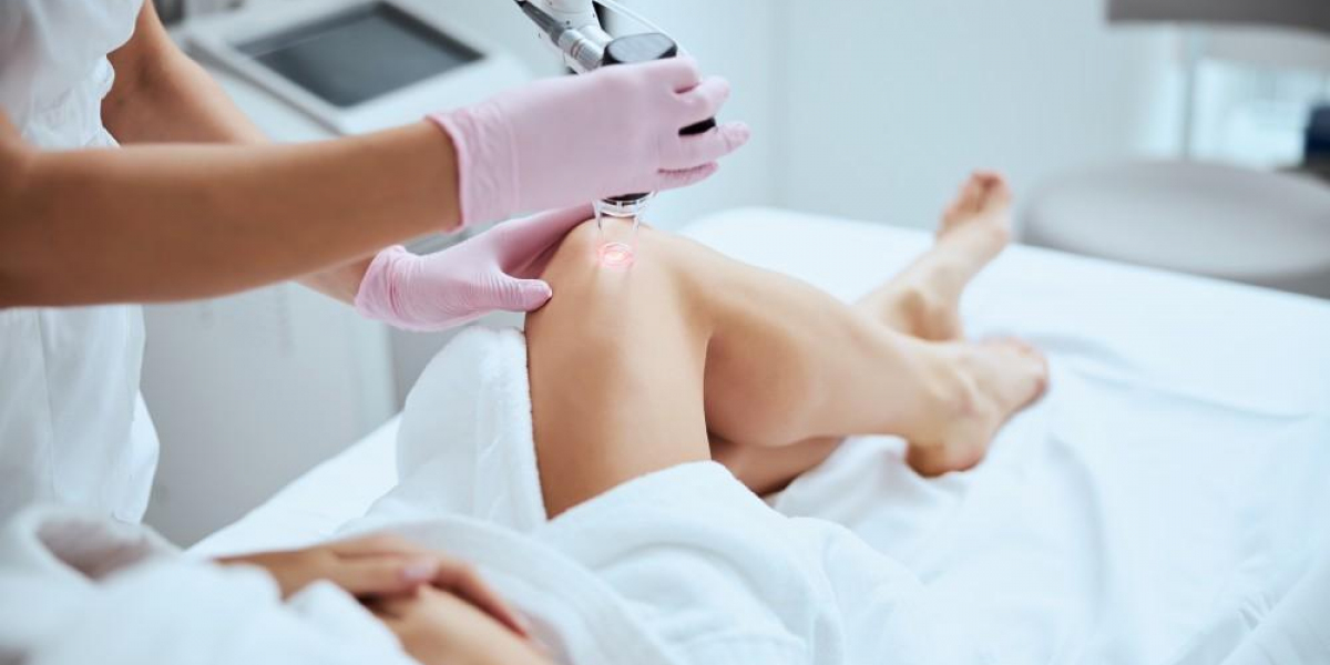 30-Minute Miracle ⭐ Kyiv’s Painless Varicose Vein Treatment